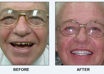before after dentist summerville sc