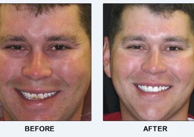 before after family dentistry