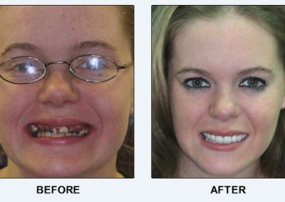 before after family dentistry