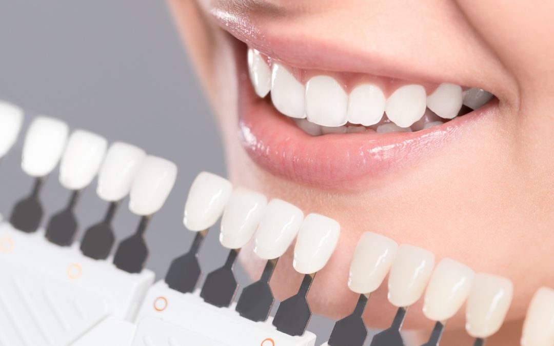 What To Know About the Best Cosmetic Dentistry Makeover Near You