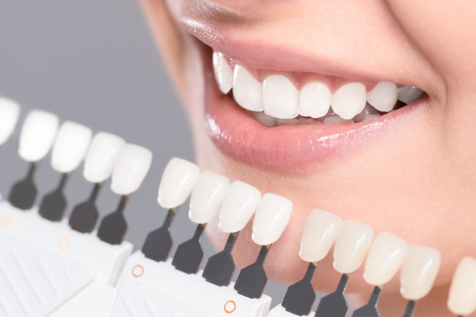 What To Know About the Best Cosmetic Dentistry Makeover Near You SMILE! Advanced Dental Center