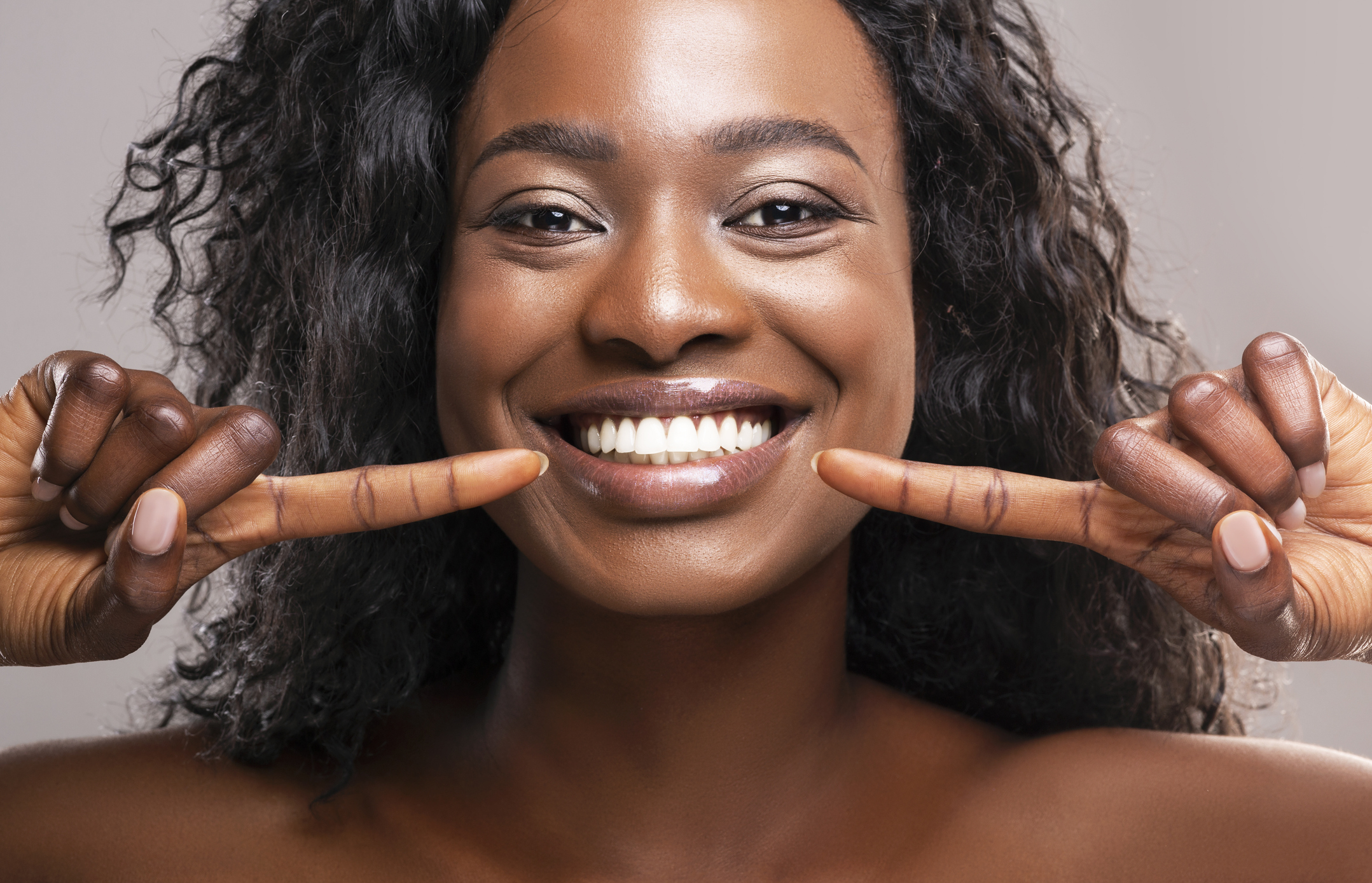 Happy black woman pointing at her perfect white teeth Professional Teeth Whitening in Summerville SC