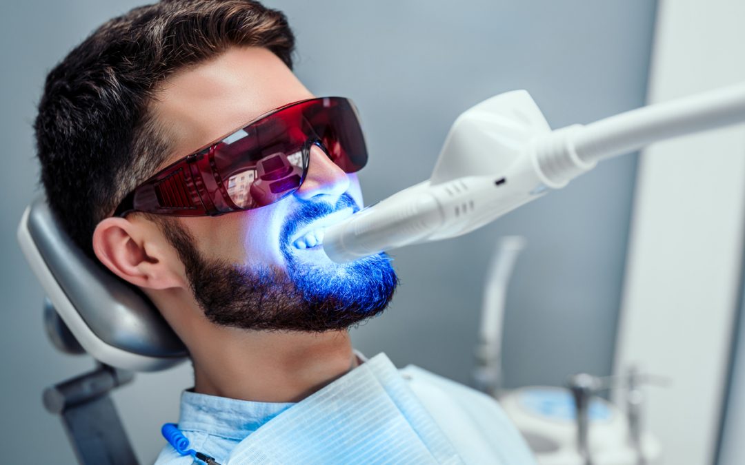 What You Need To Know About Professional Teeth Whitening in Summerville, SC