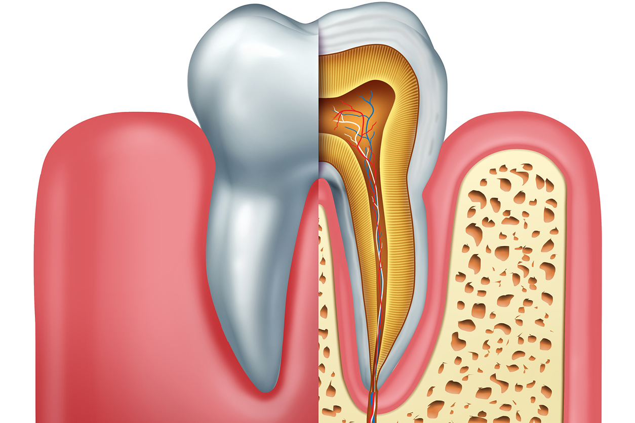 Professional Teeth Whitening in Summerville SC