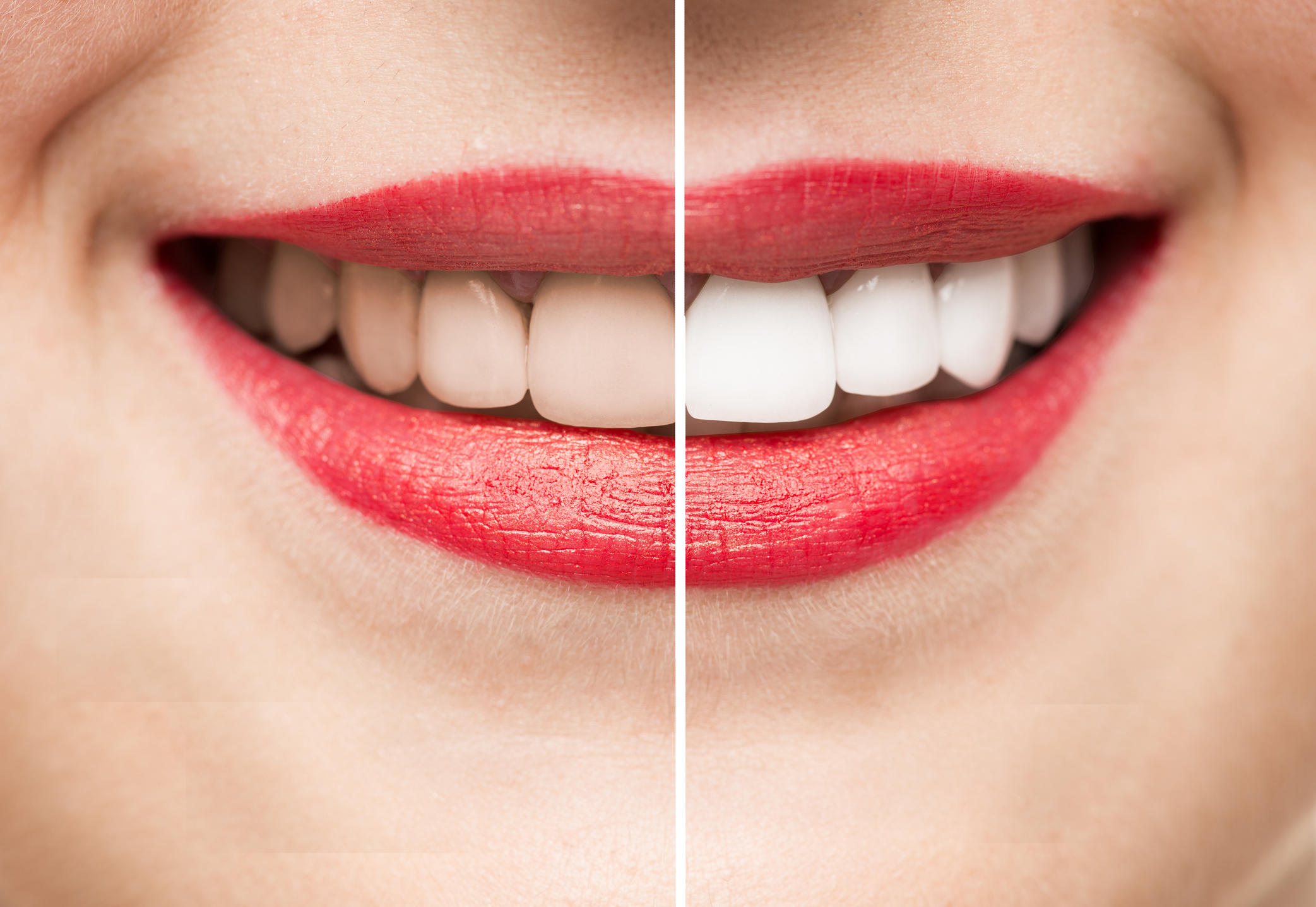 Extreme Makeover — For Your Mouth! Our “Smile Makeovers” Are A Transformational Cosmetic Dentistry Treatment